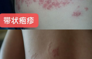 周勤荣获拾遗传承“中式全息能量调理技艺非物质文化遗产传承大师”称号