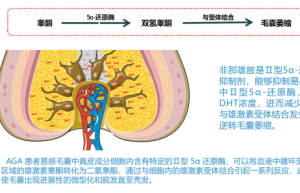 “启悦非那雄胺片：科学治秃，安全守护每一根发丝”